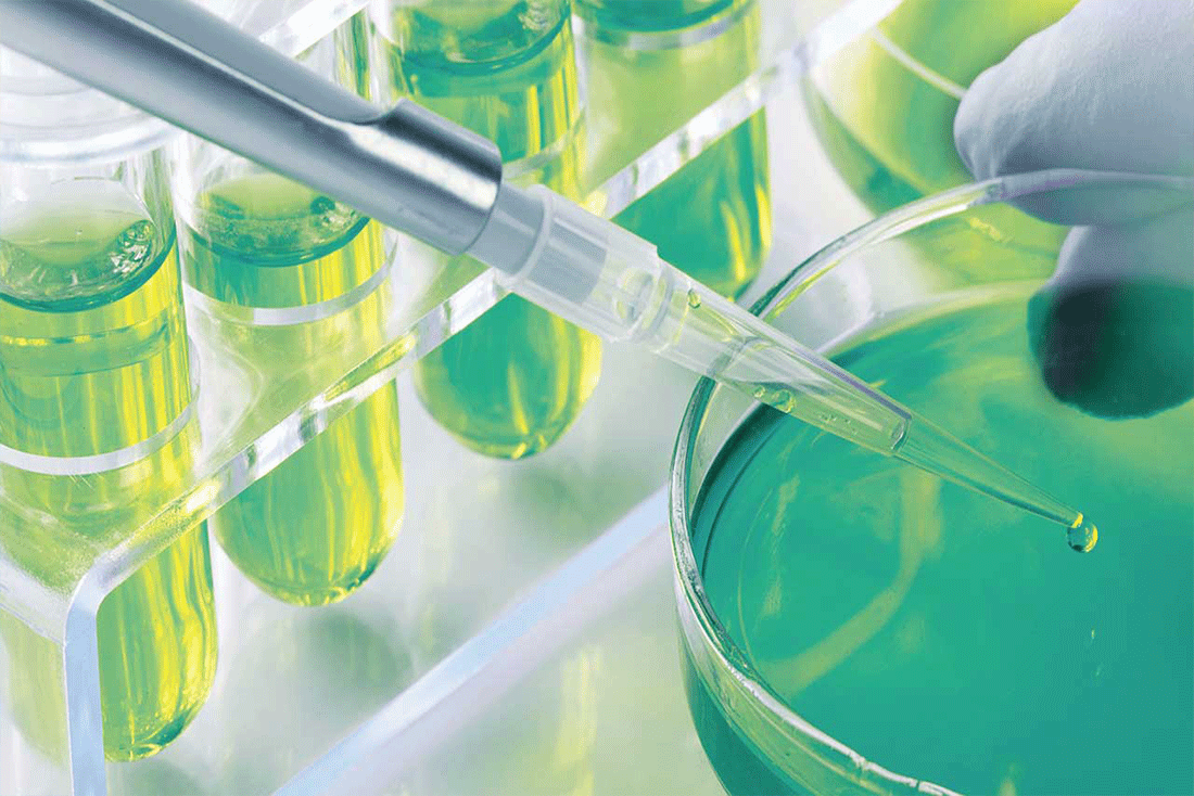 آزمایش ادرار آزمایش ادرار