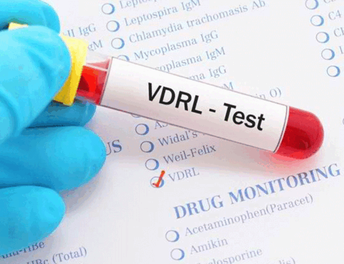 آزمایش سیفلیس (VDRL, RPR)