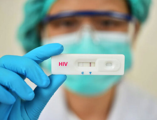 ایدز  HIV