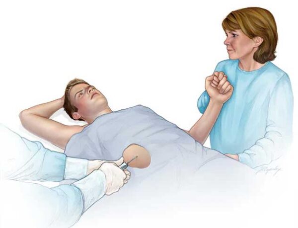 نمونه برداری کبد