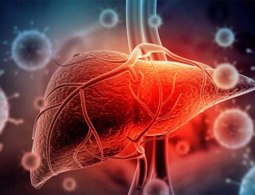 هپاتیت ناشی از الکل